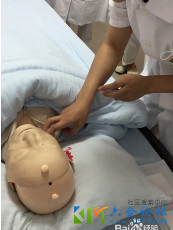 心肺复苏